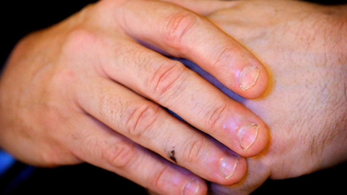 Experten halten das Fingerknacken für alles andere als einen harmlosen Tick. (Foto)