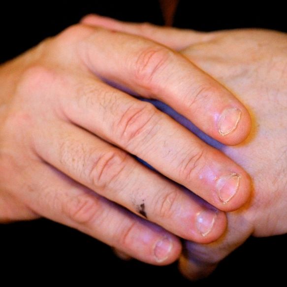 Fingerknacken besser lassen