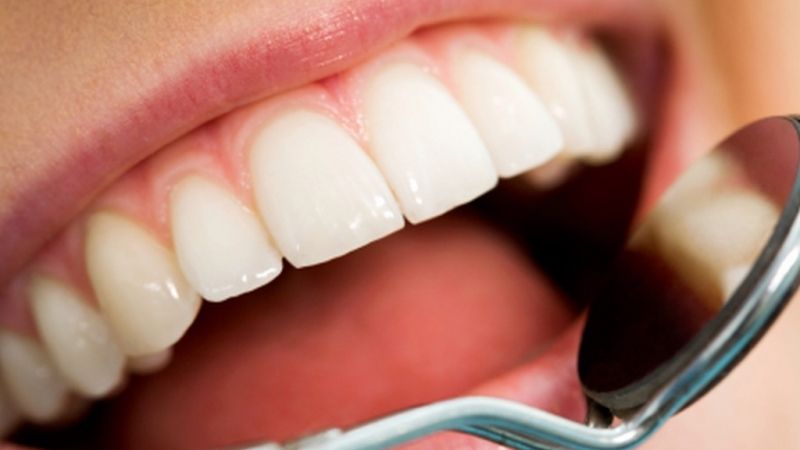 Zahnuntersuchung (Foto)