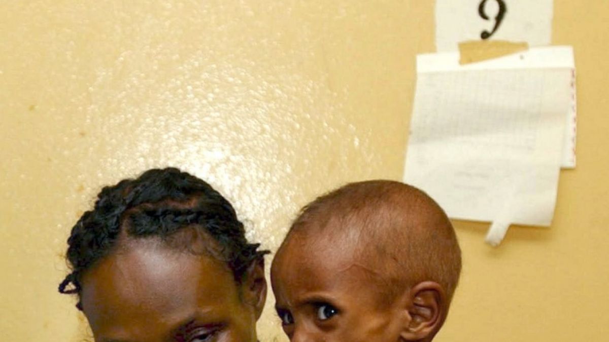 Die Hunger-Gefahr in Äthiopien ist noch immer nicht gebannt. Hier wartet ein unterernährtes Kind mit seiner Mutter im Krankenhaus von Dilla auf Behandlung. (Foto)