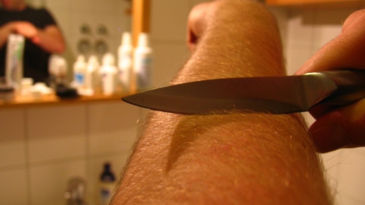 Häufig verletzen sich die Jugendlichen mit Messer oder Schere an den Armen. (Foto)