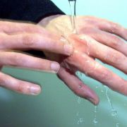 Verbrennungen ersten und zweiten Grades können selbst behandelt werden. Wichtig: Sorfort mit Wasser kühlen. Verbrennungen ersten und zweiten Grades können selbst behandelt werden. Wichtig: Sorfort mit Wasser kühlen.