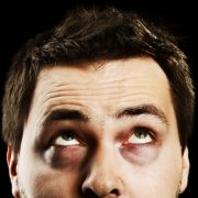 Können diese Augen lügen? An keiner anderen Körpergegend wird so schnell sichtbar, wenn die Haut um Hilfe schreit. Das Alarmsignal: Augenringe. Können diese Augen lügen? An keiner anderen Körpergegend wird so schnell sichtbar, wenn die Haut um Hilfe schreit. Das Alarmsignal: Augenringe.