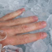 Au, das tat weh: Quetschungen, wie sie bei einem eingeklemmten Finger entstehen, sind zwar äußerst schmerzhaft, aber gut zu behandeln. Au, das tat weh: Quetschungen, wie sie bei einem eingeklemmten Finger entstehen, sind zwar äußerst schmerzhaft, aber gut zu behandeln.