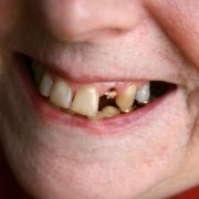 Grund 3: Liebe Damen, freuen Sie sich nicht zu früh. Grund 3: Liebe Damen, freuen Sie sich nicht zu früh.