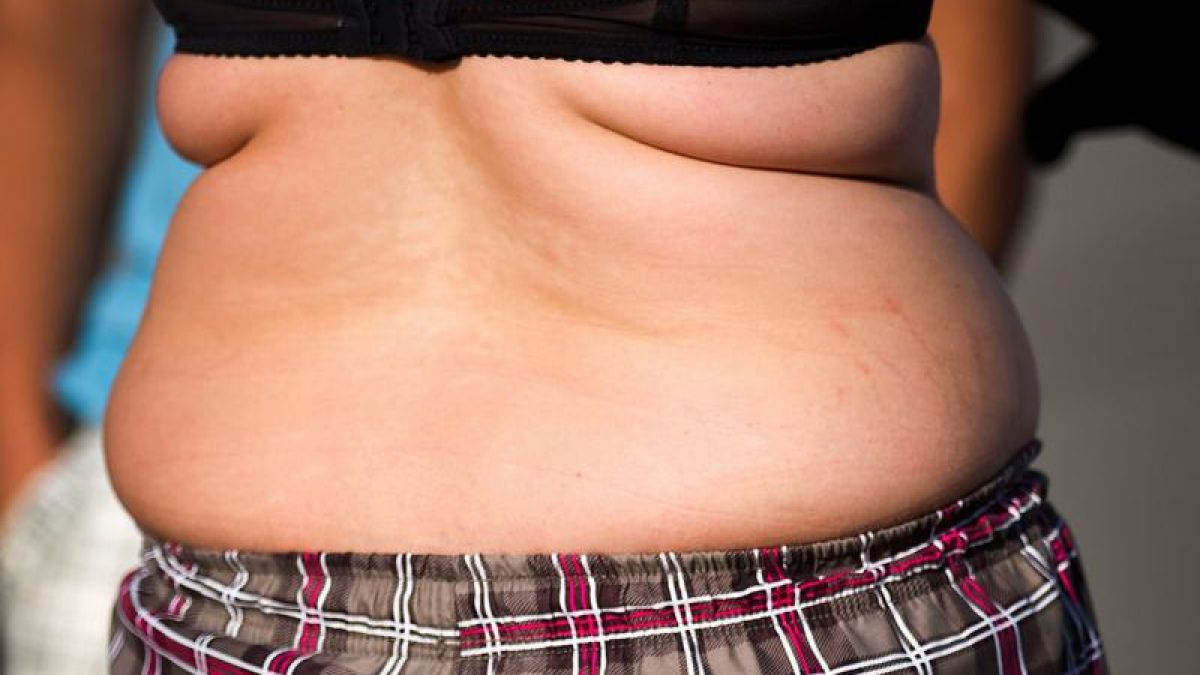 Nicht nur die Anzahl der Fettzellen ist entscheidend für Übergewicht, auch ihre Größe. (Foto)