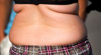 Nicht nur die Anzahl der Fettzellen ist entscheidend für Übergewicht, auch ihre Größe.