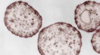Eine Mikroskop-Aufnahme des Robert-Koch-Instituts zeigt Masern-Viren: Was für uns keine ernstzunehmende Krankheit ist, endet bei isolierten Völkern oftmals mit dem Tod. Die Bo, eine Gruppe auf den Andamanen, wurde durch Masern und Grippe vollständig ausge