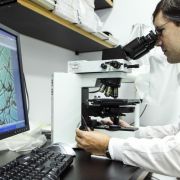 Trotzdem kann es auch in unseren Breiten zu gelegentlichen Epidemien kommen, auch wenn lediglich ungefähr elf Fälle pro 100.000 Menschen jährlich auftreten - verglichen mit bis zu 800 Fällen südlich der Sahara. Trotzdem kann es auch in unseren Breiten zu gelegentlichen Epidemien kommen, auch wenn lediglich ungefähr elf Fälle pro 100.000 Menschen jährlich auftreten - verglichen mit bis zu 800 Fällen südlich der Sahara.