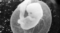 Diese Foto zeigt einen sieben Wochen alten Fötus in einer Fruchtblase.