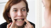 Seit zehn Jahren war Julia nicht beim Zahnarzt.