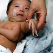 Dieses 2006 ebenfalls in China geborene Mäuschen hat einen ganzen Arm übrig. Dieses 2006 ebenfalls in China geborene Mäuschen hat einen ganzen Arm übrig.