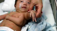 Dieses 2006 ebenfalls in China geborene Mäuschen hat einen ganzen Arm übrig.