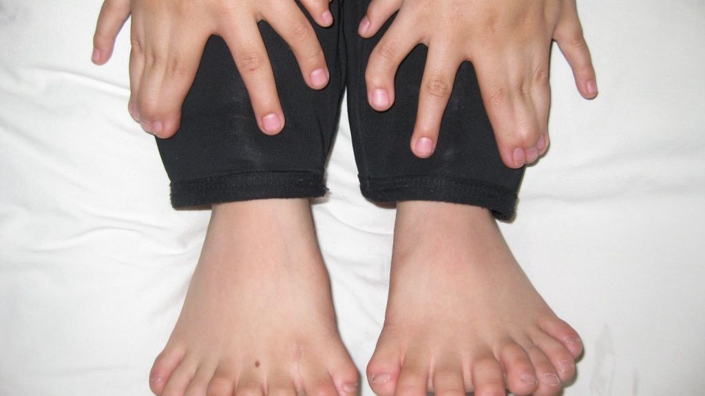 15 Finger, 16 Zehen: So viele Finger und Zehen wie bei diesem kleine Junge aus dem Nordosten Chinas wurden zuvor noch nie bei einem Menschen gezählt. (Foto)