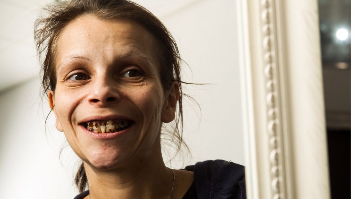 Seit zehn Jahren war Antje nicht mehr beim Zahnarzt. Bei Extrem schön! auf RTL2 soll sich ihr Äußeres nun endlich ändern. (Foto)