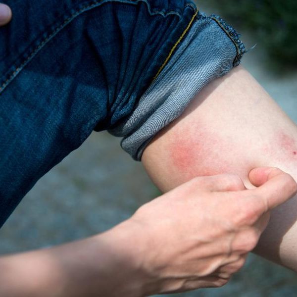 Dieses Symptom nimmt aktuell stark zu
