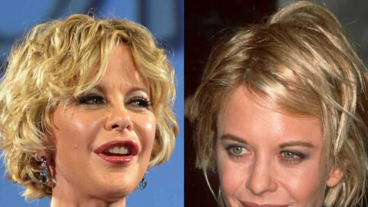 Meg Ryan in den Jahren 2013 (links) und 1997: Der Unterschied ist deutlich. Lippen sind aufgespritzt, Wangen unterpolstert. (Foto)