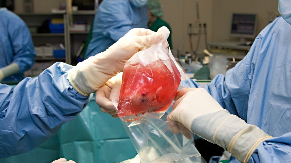 Eine US-Amerikanerin musste ihre Organspende bitter bereuen (Symbolbild). (Foto)