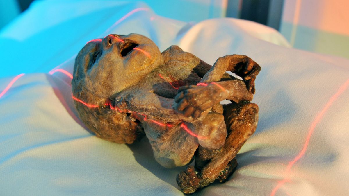 Das Bild zeigt einen mumifizierten Fötus aus dem frühen 18. Jahrhundert. (Foto)