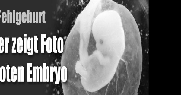 Embryo 9. Woche Fehlgeburt 9. SSW 9. Schwangerschaftswoche So