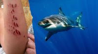 An einem Strand auf Gran Canaria hat ein Hai eine Touristin angegriffen.