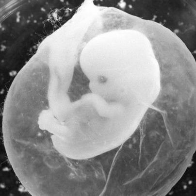 Schwangerschafts-Mythen und was wirklich dahinter steckt Schwangerschafts-Mythen und was wirklich dahinter steckt (Foto)