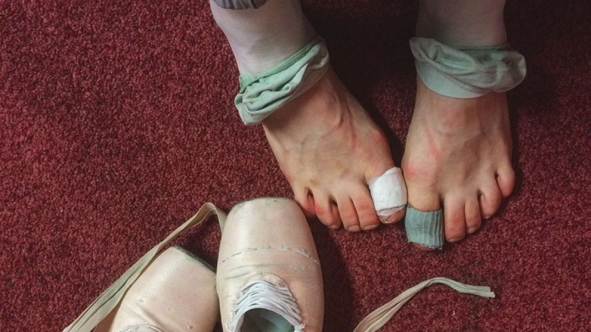 Darian Volkovas Füße leiden sichtlich unter dem Balletttanz. (Foto)