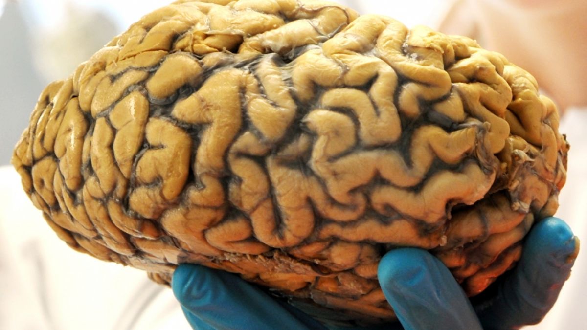 Ein Wissenschaftler hält am 21. Februar 2013 im Institut für Anatomie der Universität Leipzig (Sachsen) ein menschliches Gehirn in seiner Hand. (Foto)