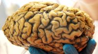 Ein Wissenschaftler hält am 21. Februar 2013 im Institut für Anatomie der Universität Leipzig (Sachsen) ein menschliches Gehirn in seiner Hand.