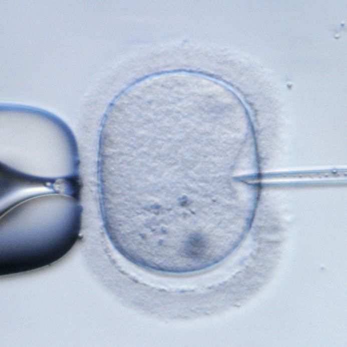 Arzt schwängert Frauen mit eigenem Sperma Arzt schwängert Frauen mit eigenem Sperma (Foto)