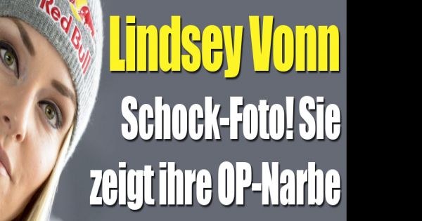 Lindsey Vonn verletzt Oberarmbruch! Sie zeigt die SchockFotos ihrer