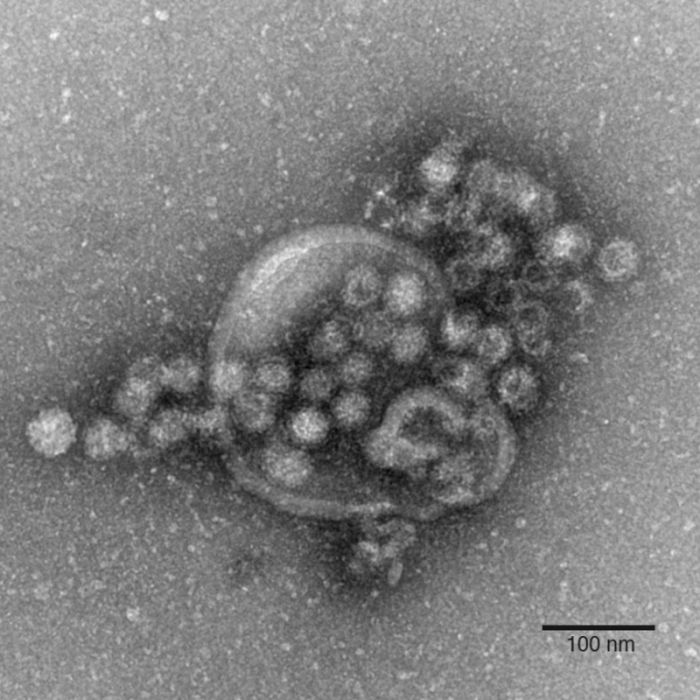 So schützen Sie sich vor einer Ansteckung mit dem Magen-Darm-Virus So schützen Sie sich vor einer Ansteckung mit dem Magen-Darm-Virus (Foto)