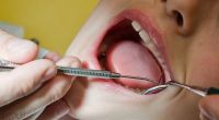 Laut einer Taiwanesischen Studie sollten Frauen bei Männern vor allem auf die Zähne schauen (Symbolbild).