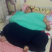 Die 36-jährige Eman Ahmed wurde zur Behandlung in das Saifee Krankenhaus in Mumbai gebracht. Die 36-jährige Eman Ahmed wurde zur Behandlung in das Saifee Krankenhaus in Mumbai gebracht.