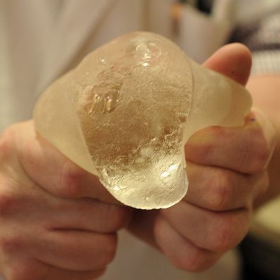 Krebs-Gefahr! Die wahre Geschichte hinter den Implantat-Skandal Krebs-Gefahr! Die wahre Geschichte hinter den Implantat-Skandal (Foto)