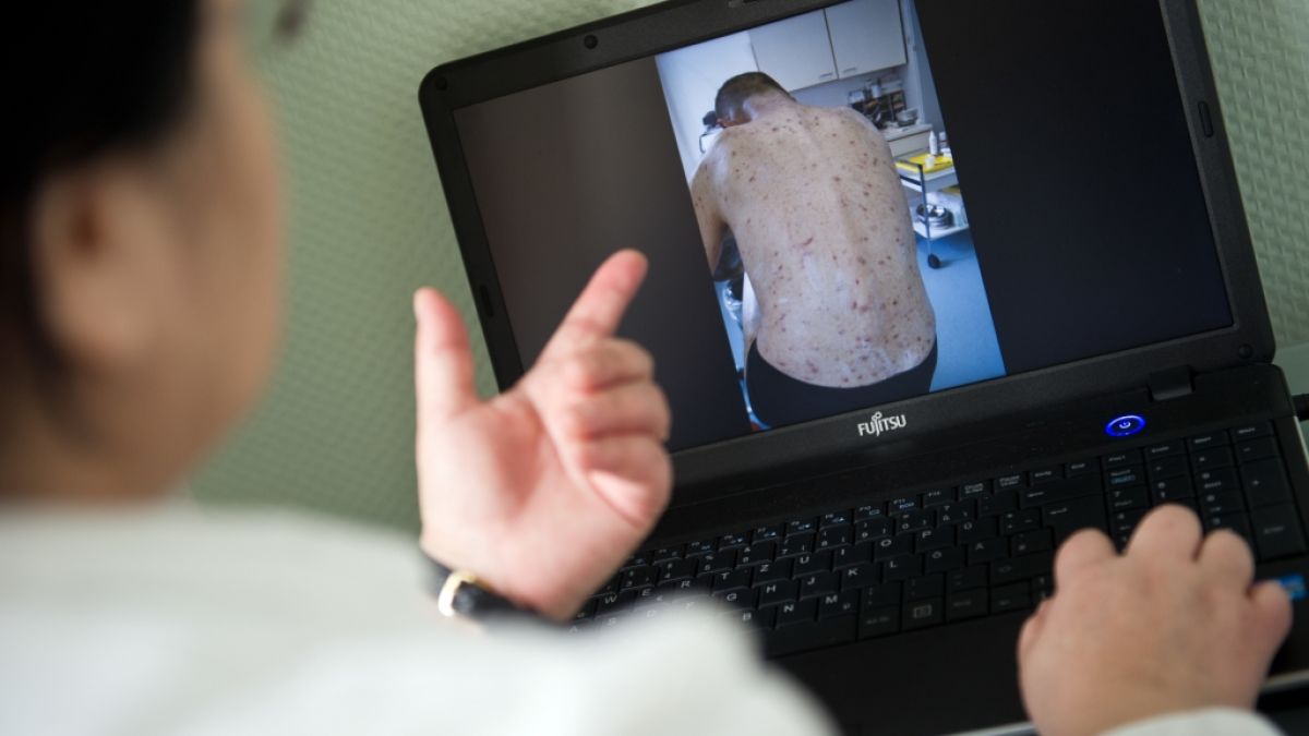 Die Obdachlosen-Ärztin Jenny De la Torre zeigt ein Foto auf ihrem Laptop von einem Patienten, der von Krätze befallen ist. (Foto)