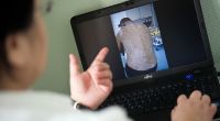 Die Obdachlosen-Ärztin Jenny De la Torre zeigt ein Foto auf ihrem Laptop von einem Patienten, der von Krätze befallen ist.