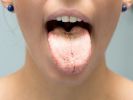 Das Aussehen der Zunge verrät eine Menge über unsere Gesundheit. (Foto)