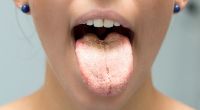 Das Aussehen der Zunge verrät eine Menge über unsere Gesundheit.