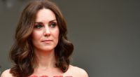 Bei öffentlichen Auftritten versteckt Kate Middleton ihre Narbe an der linken Schläfe hinter einer breiten Haarsträhne.
