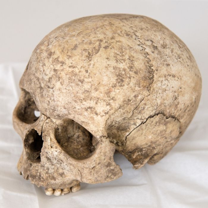 Lebendes Skelett! Mann ohne Nase und Ohren will sich PENIS abhacken