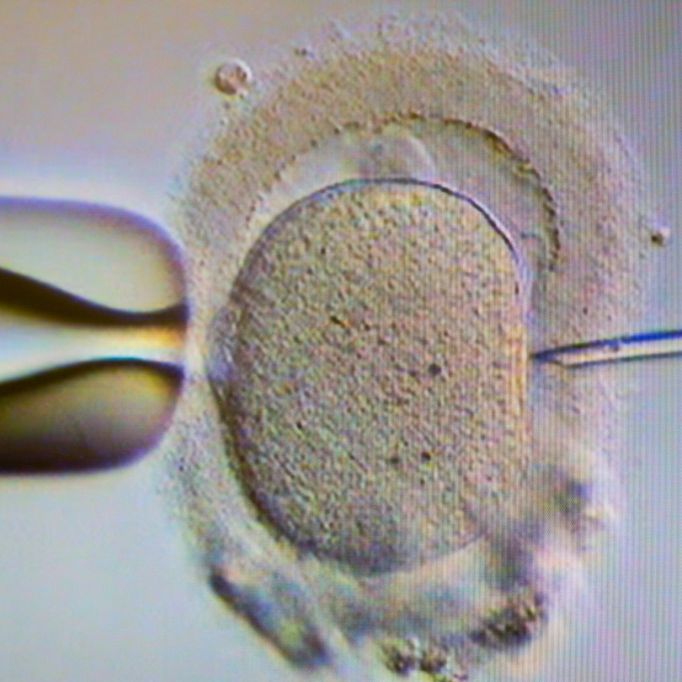 Irre Schwangerschaft! Baby von ZWEI Müttern ausgetragen Irre Schwangerschaft! Baby von ZWEI Müttern ausgetragen (Foto)