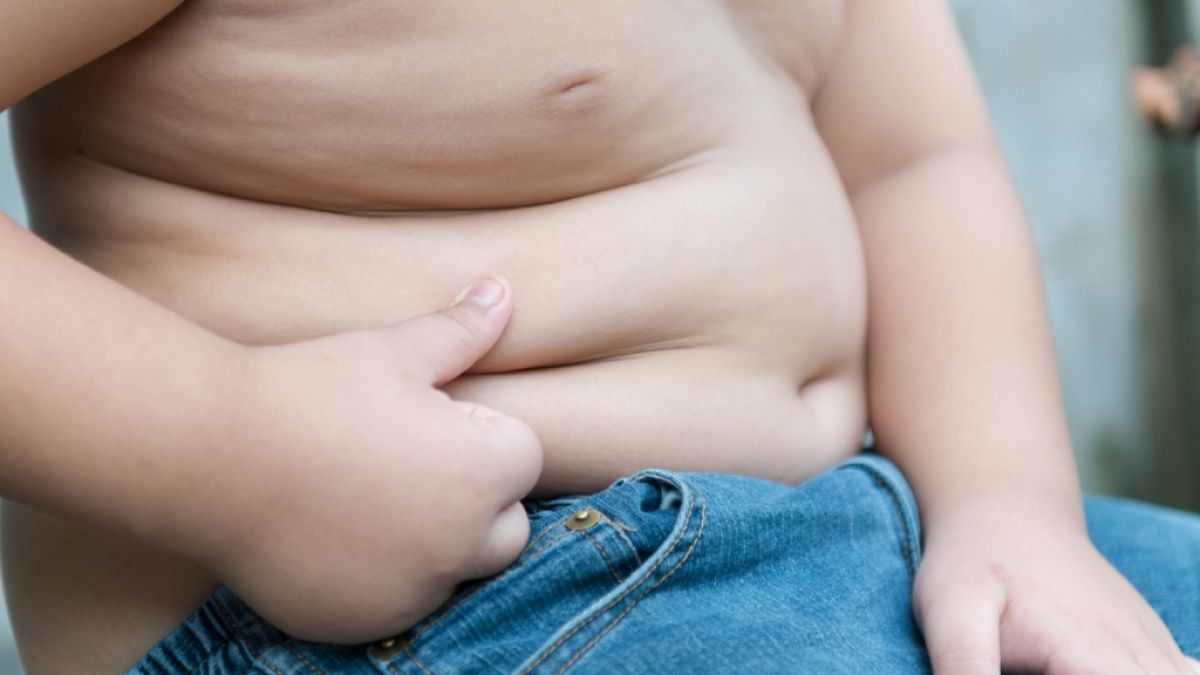 Der dickste Junge der Welt hat 89 Kilogramm abgenommen. (Symbolbild) (Foto)