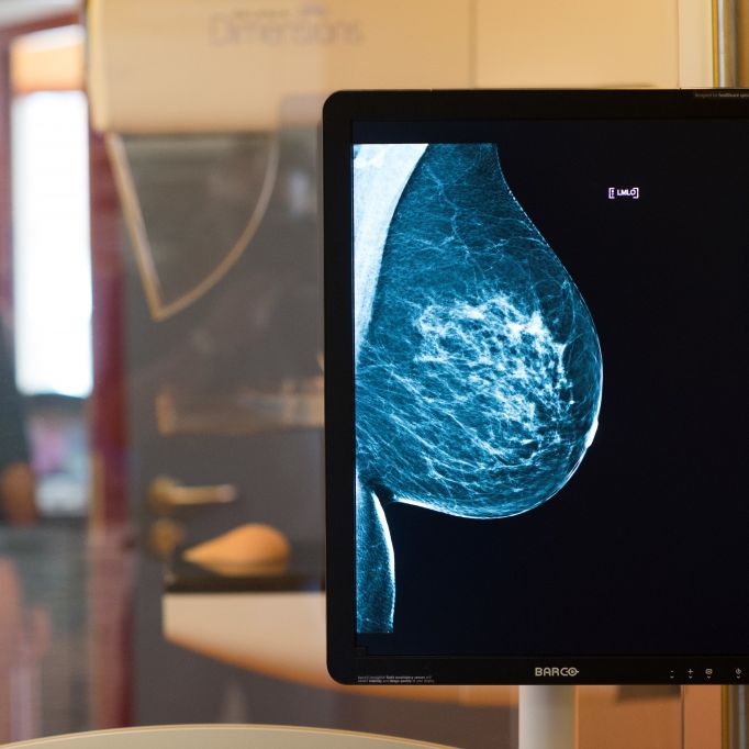 Welche Check-up-Untersuchungen sind kostenlos und was zahlt die Kasse? Welche Check-up-Untersuchungen sind kostenlos und was zahlt die Kasse? (Foto)