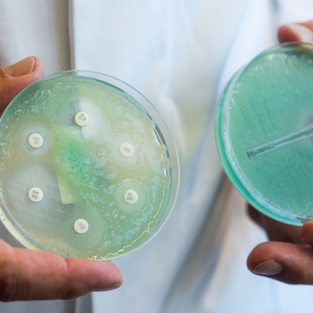 Antibiotika zunehmend wirkungslos! Killer-Keime auf dem Vormarsch Antibiotika zunehmend wirkungslos! Killer-Keime auf dem Vormarsch (Foto)