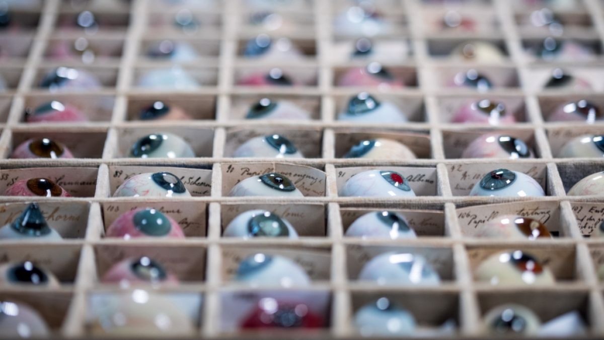 Erkrankungen des Auges gibt es viele. Im Museum für Augenmedizin gibt es Glasaugen, an denen Ärzte früher lernten, Krankheiten zu erkennen. (Foto)