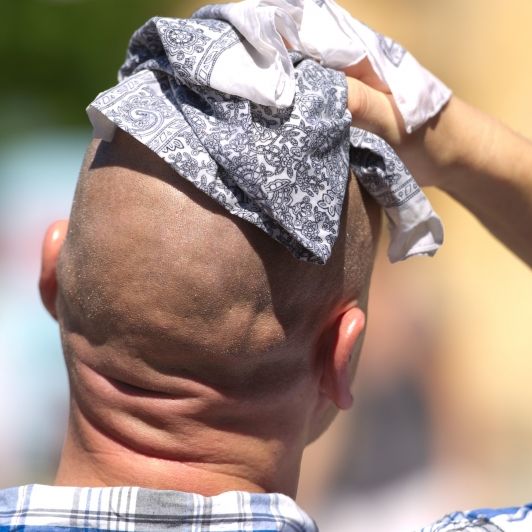 DIESE Krankheiten treten bei Sommer-Hitze öfter auf DIESE Krankheiten treten bei Sommer-Hitze öfter auf (Foto)