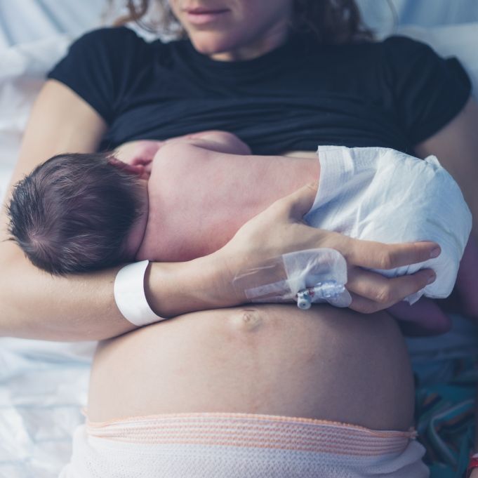 Frau bringt Baby mit 3 Beinen und 2 Penissen auf die Welt