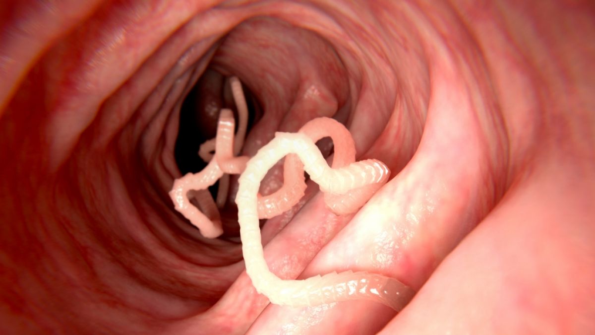 Ein Chinese hatte 15 Jahre lang einen Bandwurm in seinem Körper. (Foto)