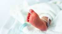 In Aserbaidschan wurde ein Baby mit extremen Fehlbildungen geboren.